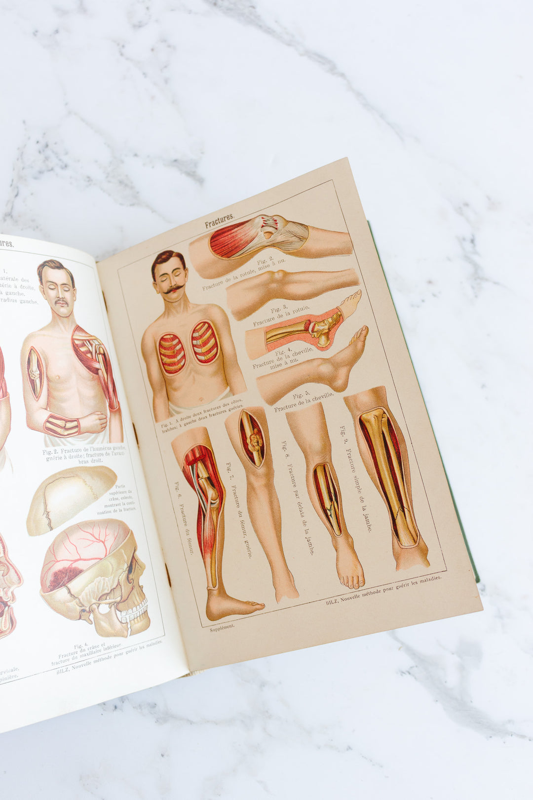 art nouveau medical Bilz book